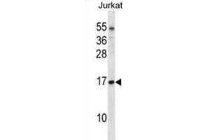 Western Blotting (WB) image for anti-Transcription Elongation Factor B (SIII), Polypeptide 1 (15kDa, Elongin C) (TCEB1) antibody (ABIN2998260) (TCEB1 anticorps)