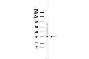 anti-Aldo-Keto Reductase Family 1, Member E2 (AKR1E2) (Internal Region) antibody