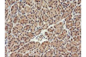 Image no. 1 for anti-F-Box Protein 21 (FBXO21) antibody (ABIN1498234)