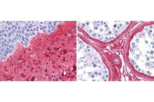 anti collagen III antibody (600-401-105 Lot 26016, 1:400, 45 min RT) showed strong staining in FFPE sections of human skin(left, dermis) with moderate to strong red staining and testis (right) where strong staining was observed within connective tissue between seminiferous tubules. (COL3 anticorps  (Biotin))