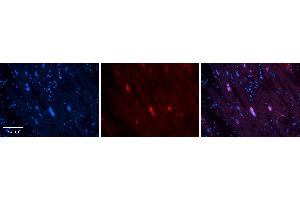 Rabbit Anti-MCM4 Antibody   Formalin Fixed Paraffin Embedded Tissue: Human heart Tissue Observed Staining: Nucleus Primary Antibody Concentration: 1:100 Other Working Concentrations: N/A Secondary Antibody: Donkey anti-Rabbit-Cy3 Secondary Antibody Concentration: 1:200 Magnification: 20X Exposure Time: 0. (MCM4 anticorps  (Middle Region))