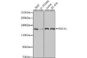Western blot analysis of extracts of various cell lines using ROCK1 Polyclonal Antibody at dilution of 1:1000. (ROCK1 anticorps)
