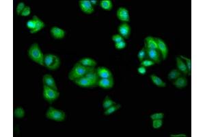Immunofluorescence staining of HepG2 cells with ABIN7143624 at 1:233, counter-stained with DAPI.
