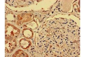 Immunohistochemistry analysis of human kidney tissue using ABIN7156038 at dilution of 1:100 (IgD anticorps  (AA 1-240))