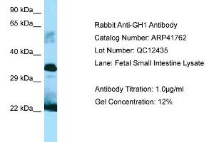 Western Blotting (WB) image for anti-Growth Hormone 1 (GH1) (C-Term) antibody (ABIN2776979) (Growth Hormone 1 anticorps  (C-Term))