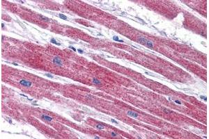 Human Heart: Formalin-Fixed, Paraffin-Embedded (FFPE)