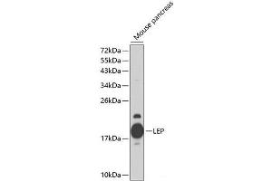 Western blot analysis of extracts of Mouse pancreas using LEP Polyclonal Antibody at dilution of 1:1000. (Leptin anticorps)