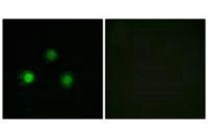Immunofluorescence analysis of HUVEC cells, using MSH2 antibody.