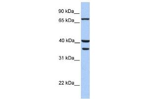 Western Blotting (WB) image for anti-Transglutaminase 5 (TGM5) antibody (ABIN2459269) (Transglutaminase 5 anticorps)