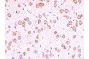 Immunohistochemistry of TLR5 in rat brain tissue with this product at 10 μg/ml. (TLR5 anticorps  (Center))