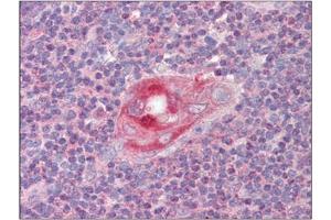 Image no. 3 for anti-Regulator of G-Protein Signaling 1 (RGS1) (C-Term) antibody (ABIN374207) (RGS1 anticorps  (C-Term))