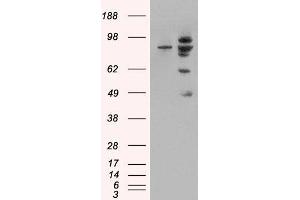 HEK293 overexpressing MDM2 (ABIN5451314) and probed with ABIN185508 (mock transfection in first lane). (MDM2 anticorps  (Internal Region))