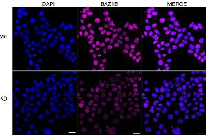 Immunocytochemical staining of HeLa cells using BAZ1B antibody (ABIN7797797), 1:1,000), Top panel: wild-type (WT), Bottom panal: BAZ1B shRNA knockdown (KD). (Recombinant BAZ1B anticorps)