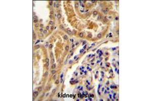 TLL2 Antibody immunohistochemistry analysis in formalin fixed and paraffin embedded human kidney tissue followed by peroxidase conjugation of the secondary antibody and DAB staining.