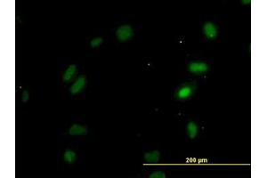 Image no. 4 for anti-Oxidative-Stress Responsive 1 (OXSR1) (AA 1-528) antibody (ABIN599106) (OXSR1 anticorps  (AA 1-528))