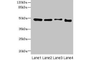 Western blot All lanes: DDI2 antibody at 4 μg/mL Lane 1: A431 whole cell lysate Lane 2: HL60 whole cell lysate Lane 3: K562 whole cell lysate Lane 4: Caco-2 whole cell lysate Secondary Goat polyclonal to rabbit IgG at 1/10000 dilution Predicted band size: 45, 24, 47 kDa Observed band size: 47 kDa (DDI2 anticorps  (AA 1-211))