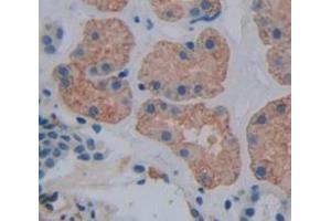 Used in DAB staining on fromalin fixed paraffin- embedded Kidney tissue