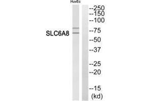 Western blot analysis of extracts from HuvEc cells, using SLC6A8 antibody.