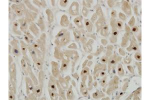Immunoperoxidase of monoclonal antibody to TTN on formalin-fixed paraffin-embedded human heart. (Titin anticorps  (AA 1-110))