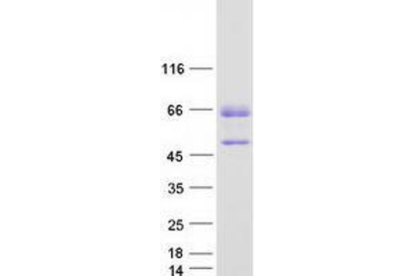 TOX2 Protein (Transcript Variant 4) (Myc-DYKDDDDK Tag)