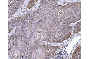 IHC analysis of ERLIN2 using anti-ERLIN2 antibody (ABIN7602582). (ERLIN2 anticorps  (AA 87-339))