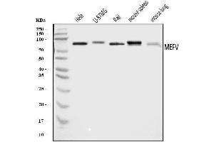 Western blot analysis of Pyrin/MEFV using anti-Pyrin/MEFV antibody (ABIN7601809).