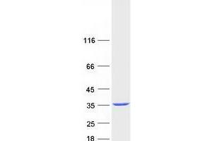 Validation with Western Blot