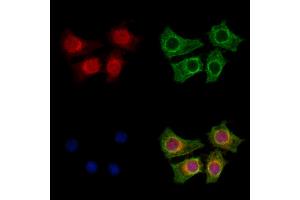ABIN7094601 and ABIN7098651 staining HepG2 cells by IF/ICC. (KCNK5 anticorps  (C-Term))