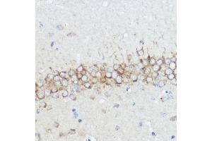 Immunohistochemistry of paraffin-embedded rat brain using  Rabbit pAb (ABIN7265359) at dilution of 1:50 (40x lens).