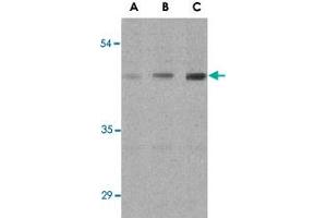 Western blot analysis of ANTXR1 in HepG2 cell lysates with ANTXR1 polyclonal antibody  at (A) 0. (ANTXR1 anticorps  (Internal Region))