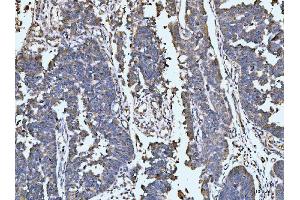 IHC analysis of LARP1 using anti-LARP1 antibody (ABIN7599861). (LARP1 anticorps  (AA 123-401))