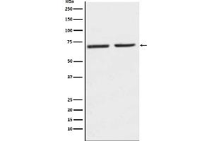 Western blot analysis of 5HT2C Receptor expression in (1) SH-SY5Y cell lysate, (2) Mouse kidney lysate.