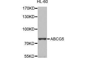 Western blot analysis of extracts of HL-60 cells, using ABCG5 antibody (ABIN5996193) at 1/1000 dilution. (ABCG5 anticorps)