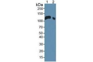 Rabbit Detection antibody from the kit in WB with Positive Control:  Sample Sample: Lane1: Mouse Serum; Lane2: Mouse Placenta Tissue. (LIFR Kit ELISA)