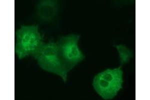 Image no. 4 for anti-Peroxisomal Trans-2-Enoyl-CoA Reductase (PECR) antibody (ABIN1500148)