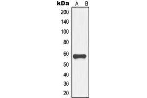 Western blot analysis of GDF9 expression in HL60 (A) whole cell lysates. (GDF9 anticorps  (Center))