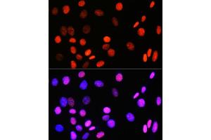 Immunofluorescence analysis of NIH-3T3 cells using DNA topoisomerase I (DNA topoisomerase I (TOP1)) Rabbit mAb (ABIN7270850) at dilution of 1:100 (40x lens).