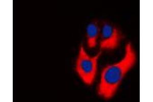 Immunofluorescent analysis of CKMT2 staining in THP1 cells.