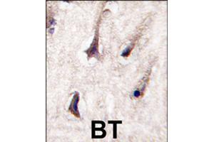 Formalin-fixed and paraffin-embedded human brain tissue reacted with PRKCB polyclonal antibody  , which was peroxidase-conjugated to the secondary antibody, followed by DAB staining . (PKC beta anticorps  (C-Term))