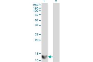 Western Blot analysis of LGALS1 expression in transfected 293T cell line by LGALS1 monoclonal antibody (M01A), clone 1E8-1B2. (LGALS1/Galectin 1 anticorps  (AA 1-135))