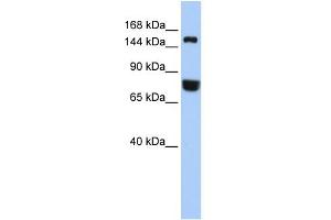 WB Suggested Anti-EEA1 Antibody Titration: 0. (EEA1 anticorps  (Middle Region))