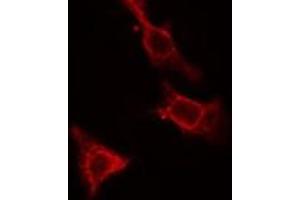 ABIN6275475 staining Hela cells by IF/ICC. (RAP2C anticorps  (Internal Region))