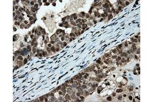 Immunohistochemistry (IHC) image for anti-Amyloid beta (A4) Precursor Protein (APP) antibody (ABIN1496877) (APP anticorps)