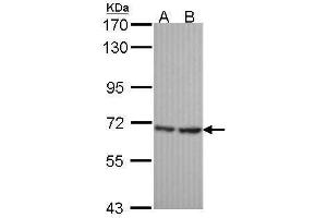 WB Image Sample (30 ug of whole cell lysate) A: Hela B: JurKat 7. (SH3BP1 anticorps  (C-Term))