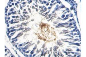 DAB staining on IHC-P; Samples: Rat Testis Tissue