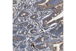 Immunohistochemical staining of human small intestine with CCDC90B polyclonal antibody  shows moderate cytoplasmic positivity at 1:20-1:50 dilution. (CCDC90B anticorps)