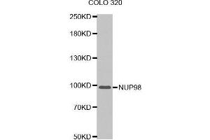 Western blot analysis of extracts of COLO 320 cells tissue, using NUP98 antibody. (NUP98 anticorps  (AA 621-920))