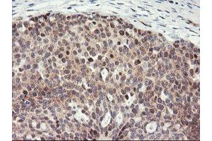 Image no. 3 for anti-Proteasome Subunit alpha 4 (PSMA4) antibody (ABIN1500457)