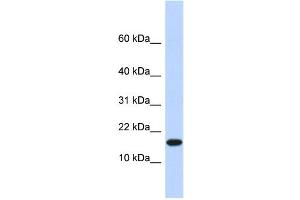 WB Suggested Anti-EGLN2 Antibody Titration:  0. (PHD1 anticorps  (N-Term))