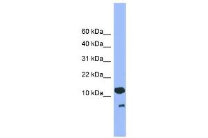 WB Suggested Anti-CDC26 Antibody Titration: 0. (CDC26 anticorps  (C-Term))